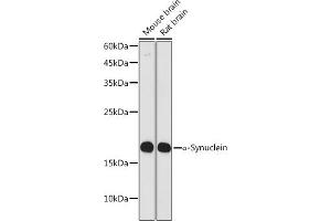 Western blot analysis of extracts of various cell lines, using α-Synuclein antibody (ABIN7270695) at 1:1000 dilution.