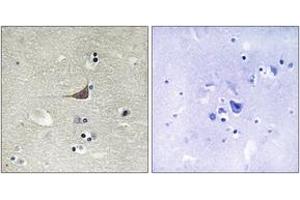 Immunohistochemistry analysis of paraffin-embedded human brain tissue, using GPR180 Antibody. (GPR180 Antikörper  (AA 241-290))