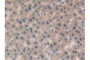 DAB staining on IHC-P; Samples: Rat Liver Tissue (IL-25 Antikörper  (AA 33-169))