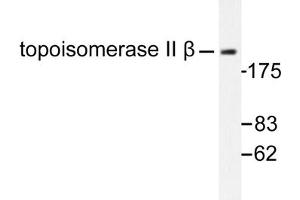 Image no. 1 for anti-Topoisomerase (DNA) II beta 180kDa (TOP2B) antibody (ABIN271965) (TOP2B Antikörper)