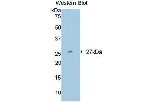 Western Blotting (WB) image for anti-Matrix Metallopeptidase 11 (Stromelysin 3) (MMP11) (AA 277-488) antibody (ABIN1078304)