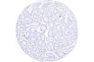 anti-Pepsinogen A antibody