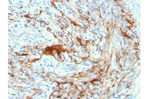 Formalin-fixed, paraffin-embedded human Small Intestine stained with Rabbit Recombinant Monoclonal Antibody (ELN/3131R) to Elastin. (Rekombinanter Elastin Antikörper)