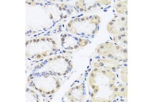 Immunohistochemistry of paraffin-embedded human stomach using RUNX1 antibody (ABIN6291786) at dilution of 1:100 (40x lens). (RUNX1 Antikörper)