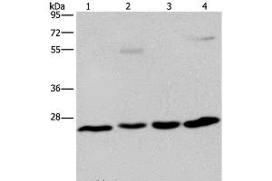 Western Blot analysis of A549 cell and Human hepatocellular carcinoma, Mouse liver tissue and HT-29 cell using ETHE1 Polyclonal Antibody at dilution of 1:400
