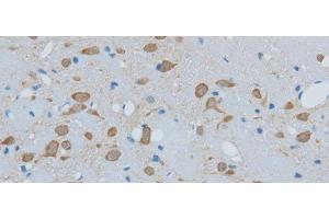 Immunohistochemistry of paraffin-embedded Mouse brain using TIMP4 Polyclonal Antibody at dilution of 1:50 (TIMP4 Antikörper)