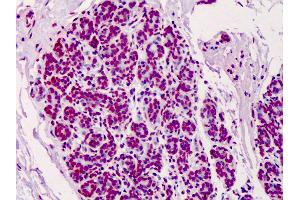 Anti-Poly ADP-Ribose antibody IHC of human breast. (Poly-ADP-Ribose Antikörper)