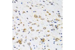 Immunohistochemistry of paraffin-embedded mouse brain using COPB2 antibody. (COPB2 Antikörper)
