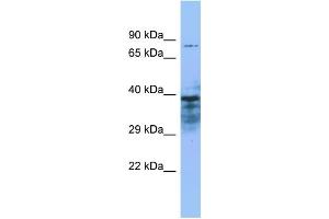 Host: Rabbit Target Name: ZMYND15 Sample Type: THP-1 Whole Cell lysates Antibody Dilution: 1. (ZMYND15 Antikörper  (N-Term))