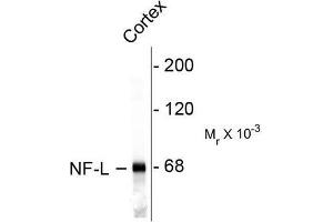 Image no. 1 for anti-Neurofilament, Light Polypeptide (NEFL) antibody (ABIN372673) (NEFL Antikörper)