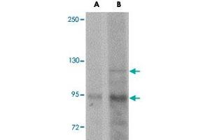Western blot analysis of KDM3A in mouse liver tissue lysate with KDM3A polyclonal antibody  at (A) 1 and (B) 2 ug/mL . (KDM3A Antikörper  (N-Term))