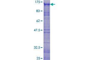 Image no. 1 for V-Myb Myeloblastosis Viral Oncogene Homolog (Avian)-Like 2 (MYBL2) (AA 1-700) protein (GST tag) (ABIN1311706)