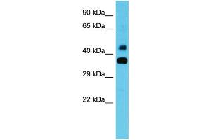 Host: Rabbit Target Name: CBWD1 Sample Type: Fetal Heart lysates Antibody Dilution: 1.