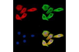 ABIN6263093 and ABIN6279535 staining Hela cells by IF/ICC. (MAP1A Antikörper  (Internal Region))