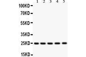 Anti-SOD2 Picoband antibody, Western blotting All lanes: Anti SOD2  at 0. (SOD2 Antikörper  (C-Term))