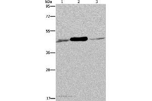 Western blot analysis of 293T and Jurkat cell, human fetal muscle tissue, using IDH2 Polyclonal Antibody at dilution of 1:600 (IDH2 Antikörper)