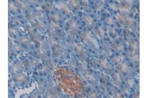 Immunohistochemistry (IHC) image for anti-Gelsolin (GSN) (AA 432-625) antibody (ABIN7429301)