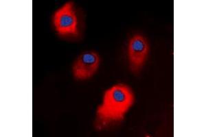 Immunofluorescent analysis of STEAP3 staining in HepG2 cells. (STEAP3 Antikörper  (C-Term))