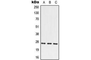 Western blot analysis of PRRX2 expression in HEK293T (A), SP2/0 (B), PC12 (C) whole cell lysates. (PRRX2 Antikörper  (N-Term))