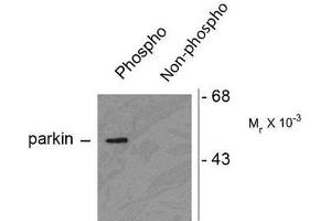 Image no. 1 for anti-Parkinson Protein 2, E3 Ubiquitin Protein Ligase (Parkin) (PARK2) (pSer378) antibody (ABIN372698) (Parkin Antikörper  (pSer378))