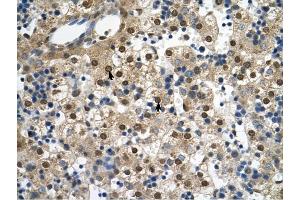SQLE antibody was used for immunohistochemistry at a concentration of 4-8 ug/ml to stain Hepatocytes (arrows) in Human Liver.