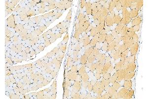 ABIN6264043 and ABIN6277757 at 1/100 staining Rat skin tissue by IHC-P.
