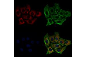 ABIN6257484 and ABIN6274780 staining HepG2 cells by IF/ICC.