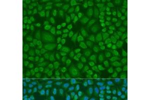 Immunofluorescence analysis of U2OS cells using DROSHA Polyclonal Antibody at dilution of 1:100. (DROSHA Antikörper)