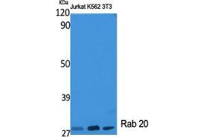Western Blot (WB) analysis of specific cells using Rab 20 Polyclonal Antibody. (RAB20 Antikörper  (Internal Region))