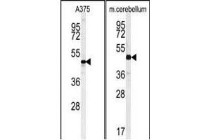 (LEFT)Western blot analysis of C10orf46 Antibody (C-term) (ABIN651189 and ABIN2840118) in  cell line lysates (35 μg/lane). (CACUL1 Antikörper  (C-Term))
