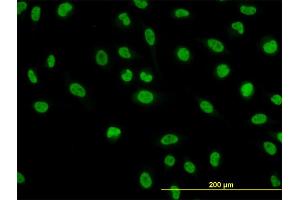 Immunofluorescence of monoclonal antibody to NFIC on HeLa cell. (NFIC Antikörper  (AA 314-423))