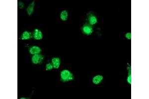 Anti-PDE4B mouse monoclonal antibody (ABIN2454961) immunofluorescent staining of COS7 cells transiently transfected by pCMV6-ENTRY PDE4B (RC211956). (PDE4B Antikörper)