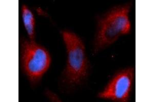 Immunofluorescence (IF) image for anti-Transforming Growth Factor, beta 1 (TGFB1) (AA 279-390) antibody (APC) (ABIN5566209) (TGFB1 Antikörper  (AA 279-390) (APC))