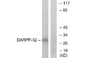 Western blot analysis of extracts from COS-7 cells, treated with forskolin (40nM, 30mins), using DARPP-32 (Ab-34) antibody. (DARPP32 Antikörper  (Thr34))