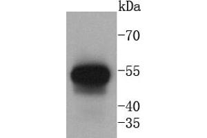 Human lung lysates probed with Cytokeratin 13 (5A3) Monoclonal Antibody at 1:1000 overnight at 4˚C. (Cytokeratin 13 Antikörper)