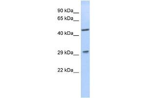WB Suggested Anti-LIX1 Antibody Titration: 0. (LIX1 Antikörper  (N-Term))