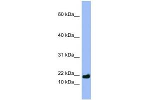 SPRR3 antibody used at 1 ug/ml to detect target protein. (SPRR3 Antikörper  (Middle Region))