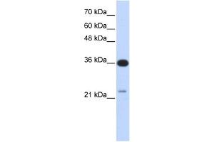 C20ORF10 antibody used at 1 ug/ml to detect target protein. (TP53TG5 Antikörper  (Middle Region))
