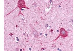 Immunohistochemical staining of Brain (Neurons and glia) using anti- OPN3 antibody ABIN122055 (OPN3 Antikörper)