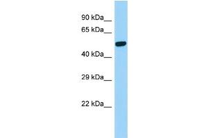 Host:  Rabbit  Target Name:  Psen2  Sample Type:  Rat Stomach lysates  Antibody Dilution:  1. (Presenilin 2 Antikörper  (C-Term))
