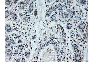 Immunohistochemical staining of paraffin-embedded breast tissue using anti-NEUROG1 mouse monoclonal antibody. (Neurogenin 1 Antikörper)