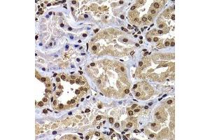 Immunohistochemistry of paraffin-embedded human kidney using DNAJB6 antibody. (DNAJB6 Antikörper  (AA 177-326))