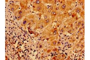 Immunohistochemistry of paraffin-embedded human liver tissue using ABIN7175121 at dilution of 1:100 (Urocortin 2 Antikörper  (AA 72-112))