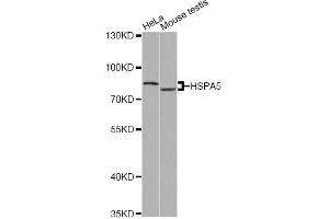 Western blot analysis of extracts of various cell lines, using HSPA5 antibody (ABIN5997938) at 1/500 dilution. (GRP78 Antikörper)