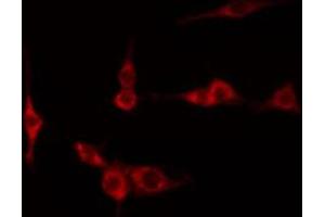 ABIN6267219 staining Hela by IF/ICC. (NFKBIE Antikörper  (pSer161))