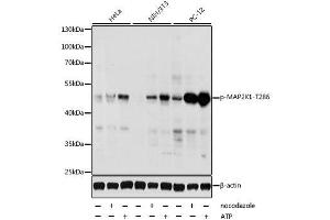 Western blot analysis of extracts of various cell lines, using Phospho-MAP2K1-T286 antibody. (MEK1 Antikörper  (pThr286))