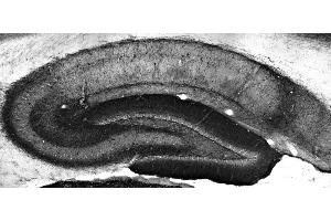 Adult rat hippocampus immunohistochemistry.