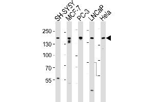 Western Blotting (WB) image for anti-Tuberous Sclerosis 2 (TSC2) (AA 1776-1805) antibody (ABIN390324)