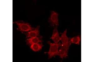 ABIN6278557 staining HepG2 by IF/ICC. (CCRL2 Antikörper  (Internal Region))