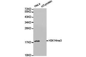 Western blot analysis of extracts of HeLa and H3 protein, using H3K14me3 antibody. (Histone 3 Antikörper  (H3K14me3))